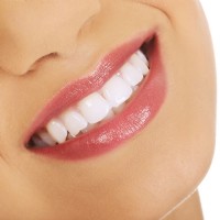 Professionelle Zahnreinigung Jennersdorf, Güssing