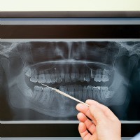 digitales röntgen, 3 d röntgen jennersdorf, güssing