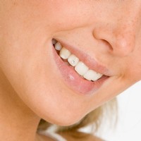 Zahnschmuck Jennersdorf Güssing